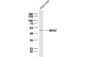 anti-MRS2 Magnesium Homeostasis Factor Homolog (MRS2) (AA 201-300) antibody