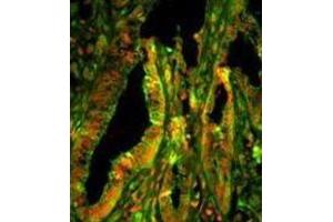 Image no. 1 for anti-Capping Protein (Actin Filament) Muscle Z-Line, alpha 1 (CAPZA1) antibody (ABIN3003245)