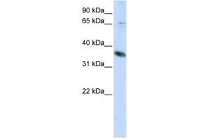 Image no. 1 for anti-ST6 (Alpha-N-Acetyl-Neuraminyl-2,3-beta-Galactosyl-1,3)-N-Acetylgalactosaminide alpha-2,6-Sialyltransferase 1 (ST6GALNAC1) (Middle Region) antibody (ABIN2773898)
