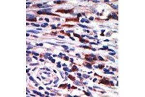 Image no. 1 for anti-Protein Kinase C, eta (PRKCH) (N-Term) antibody (ABIN359065)