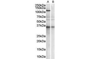 Image no. 3 for anti-Pumilio Homolog 2 (Drosophila) (PUM2) (Internal Region) antibody (ABIN185369)