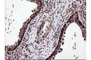 Image no. 1 for anti-Tumor Protein P73 (TP73) (AA 167-409) antibody (ABIN1491006)