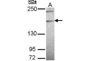 WB Image Sample (30 ug of whole cell lysate) A: 293T 5% SDS PAGE antibody diluted at 1:500