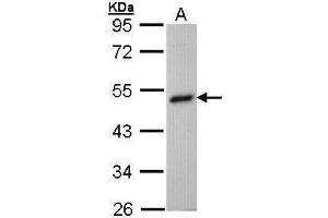 Image no. 1 for anti-Betaine--Homocysteine S-Methyltransferase (BHMT) (Center) antibody (ABIN2855528)