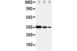 Image no. 7 for anti-SHC (Src Homology 2 Domain Containing) Transforming Protein 1 (SHC1) (AA 424-440), (C-Term) antibody (ABIN3044111)
