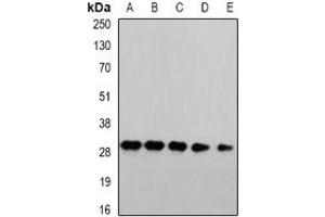 Image no. 3 for anti-Proteasome Subunit alpha 4 (PSMA4) (full length) antibody (ABIN6005022)