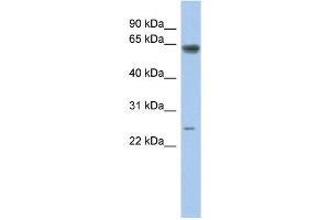 Image no. 1 for anti-TAF5-Like RNA Polymerase II, P300/CBP-Associated Factor (PCAF)-Associated Factor, 65kDa (TAF5L) (Middle Region) antibody (ABIN2779726)