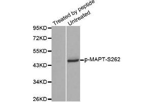 Image no. 2 for anti-Microtubule-Associated Protein tau (MAPT) (pSer262) antibody (ABIN3020340)