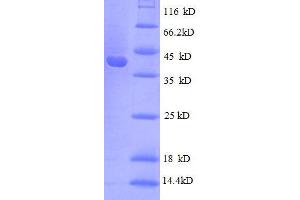 SDS-PAGE (SDS) image for 30S Ribosomal Protein S10 (RpsJ) (AA 1-103), (full length) protein (GST tag) (ABIN1046316)