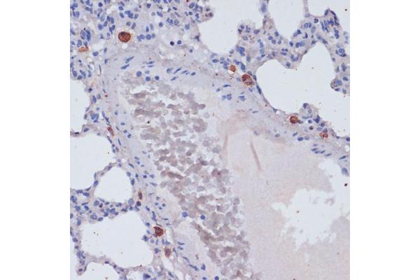 Perforin 1 antibody  (AA 280-555)