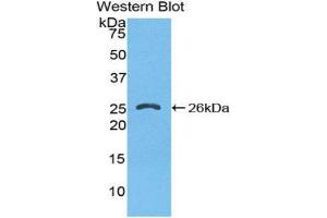 Image no. 1 for anti-FK506 Binding Protein 8, 38kDa (FKBP8) (AA 110-329) antibody (ABIN1858897)