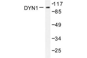 Image no. 1 for anti-Dynamin 1 (DNM1) antibody (ABIN271884)