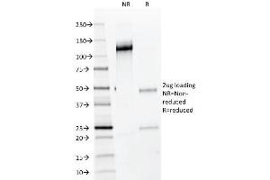 Image no. 1 for anti-NK2 Homeobox 2 (Nkx2-2) antibody (ABIN6940199)