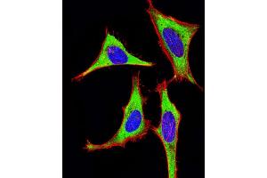 Image no. 7 for anti-MHC Class I Polypeptide-Related Sequence A (MICA) (AA 68-97) antibody (ABIN652566)