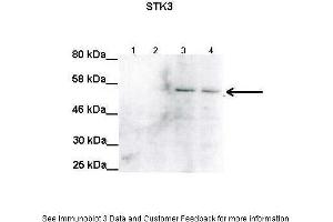 Image no. 2 for anti-serine/threonine Kinase 3 (STK3) (C-Term) antibody (ABIN2783469)