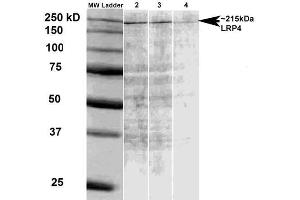 Western Blot analysis of Rat brain membrane lysate showing detection of LRP4 protein using Mouse Anti-LRP4 Monoclonal Antibody, Clone S207-27 .