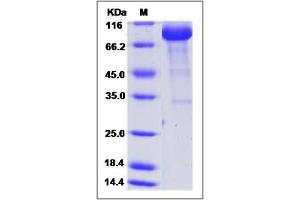 Image no. 1 for Proline Arginine Rich End Leucine Rich Repeat Protein (PRELP) (AA 21-382) protein (Fc Tag) (ABIN2005772)