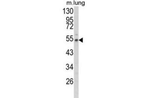 Image no. 3 for anti-Fibulin 3 (FBLN3) antibody (ABIN3004030)