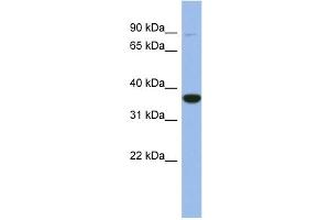 Image no. 1 for anti-Fanconi Anemia, Complementation Group L (FANCL) (Middle Region) antibody (ABIN2786637)