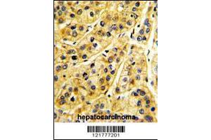 Image no. 2 for anti-MHC Class I Polypeptide-Related Sequence A (MICA) (AA 68-97) antibody (ABIN652566)