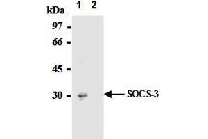 Immunoprecipitation of SOCS-3 from mouse hepatocytes with AM26562AF-N  or mouse IgG1  After immunoprecipitated with the antibody, immunocomplex was resolved on SDS-PAGE and immunoblotted with biotinylated anti-SOCS-3 monoclonal antibody.