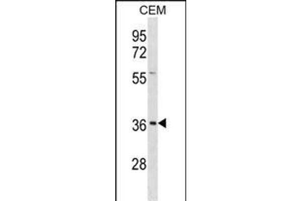 Ephrin B1 Antikörper  (AA 88-116)