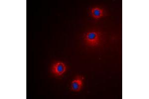 Image no. 1 for anti-Granzyme H (Cathepsin G-Like 2, Protein H-CCPX) (GZMH) (Center) antibody (ABIN2706278)