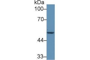 Image no. 3 for anti-Interferon Regulatory Factor 6 (IRF6) (AA 150-445) antibody (ABIN1859476)