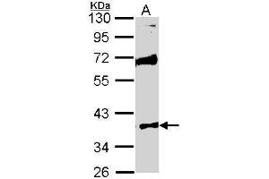 Image no. 2 for anti-Serine/threonine-Protein Kinase MST4 (MST4) (Center) antibody (ABIN2856940)