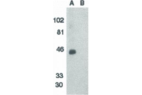 anti-Chemokine (C-X-C Motif) Receptor 6 (CXCR6) (N-Term) antibody