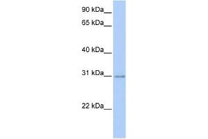 Image no. 1 for anti-Homeobox C11 (HOXC11) (Middle Region) antibody (ABIN2777521)