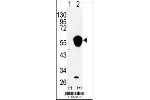 Image no. 3 for anti-Aldehyde Dehydrogenase 3 Family, Member A1 (ALDH3A1) (AA 69-99), (N-Term) antibody (ABIN392318)