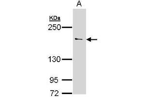 Image no. 2 for anti-Unc-13 Homolog B (UNC13B) (Internal Region) antibody (ABIN2856793)