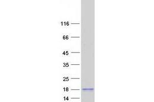 Sperm Acrosome Associated Protein 4 (SPACA4) protein (Myc-DYKDDDDK Tag)