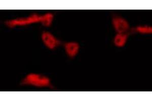 Image no. 1 for anti-Aryl Hydrocarbon Receptor (AHR) (pSer36) antibody (ABIN6256291)