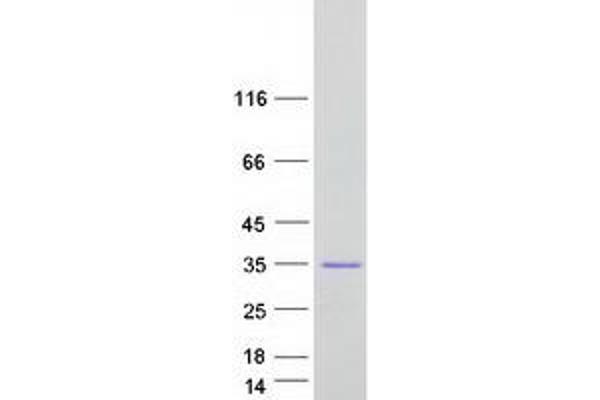 Testis Expressed 40 (TEX40) protein (Myc-DYKDDDDK Tag)