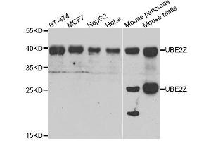 Image no. 2 for anti-Ubiquitin-Conjugating Enzyme E2Z (UBE2Z) antibody (ABIN2560646)