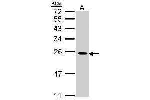 Image no. 1 for anti-Related RAS Viral (R-Ras) Oncogene Homolog 2 (RRAS2) (Center) antibody (ABIN2856766)