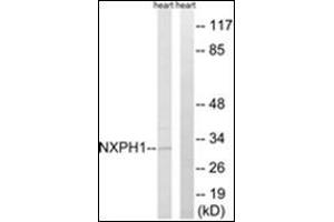 Image no. 2 for anti-Neurexophilin 1 (NXPH1) (C-Term) antibody (ABIN1449758)