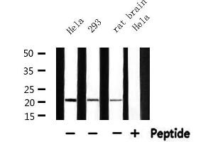 Image no. 1 for anti-Mitochondrial Ribosomal Protein L11 (MRPL11) (Internal Region) antibody (ABIN6257350)
