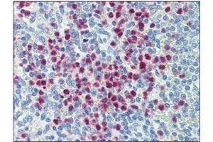 anti-Myeloid-Associated Differentiation Marker (MYADM) antibody