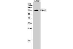 Image no. 2 for anti-Dystrophia Myotonica-Protein Kinase (DMPK) (N-Term) antibody (ABIN3184320)