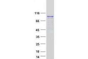 Image no. 1 for DEAH (Asp-Glu-Ala-His) Box Polypeptide 15 (DHX15) protein (Myc-DYKDDDDK Tag) (ABIN2719457)