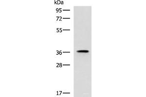 Western blot analysis of Mouse adrenal gland tissue lysate using USP50 Polyclonal Antibody at dilution of 1:400