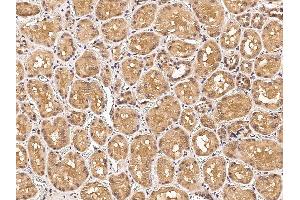 Image no. 1 for anti-Macrophage Stimulating 1 Receptor (C-Met-Related tyrosine Kinase) (MST1R) (AA 1-571) antibody (ABIN6923241)