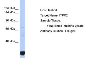Image no. 1 for anti-Inositol 1,4,5-Trisphosphate Receptor, Type 2 (ITPR2) (N-Term) antibody (ABIN2776138)