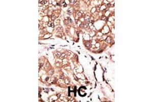 Image no. 4 for anti-Autophagy related 4D Cysteine Peptidase (ATG4D) (Center) antibody (ABIN2159344)