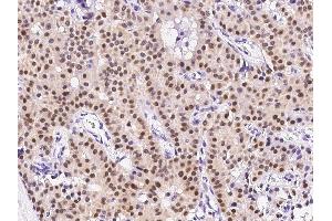 Image no. 1 for anti-Activating Transcription Factor 1 (AFT1) (N-Term) antibody (ABIN6924002)