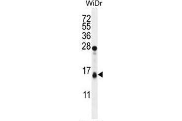 TOMM20L antibody  (N-Term)