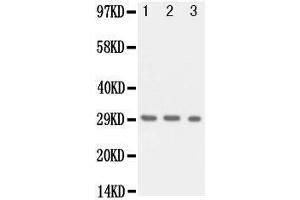 Image no. 2 for anti-Kallikrein 1 (KLK1) (AA 182-197), (Middle Region) antibody (ABIN3043141)